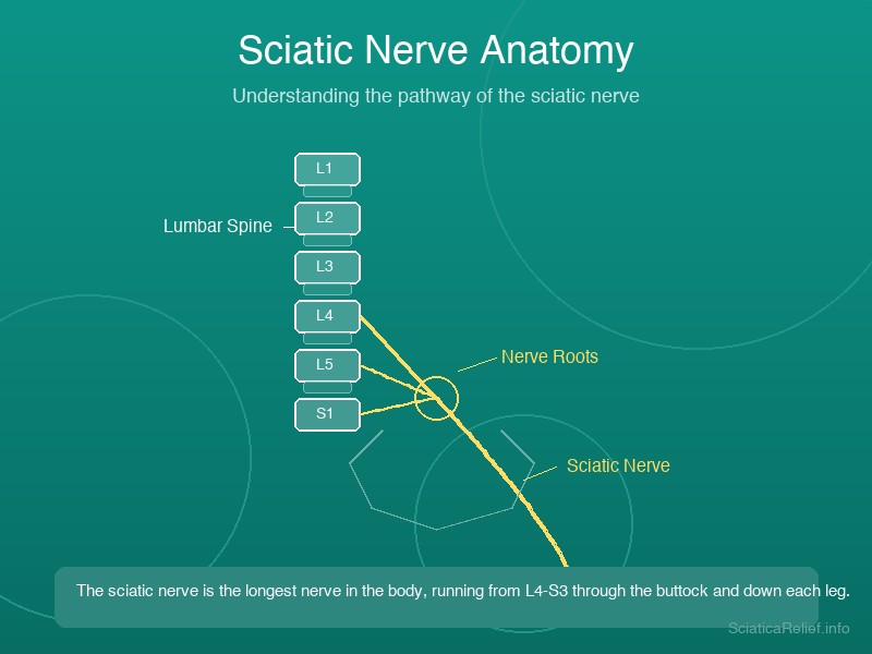 Anatomical diagram showing the sciatic nerve pathway from the lumbar spine through the piriformis muscle and down the back of each leg